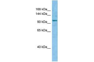 WB Suggested Anti-WWC1 Antibody Titration: 1. (WWC1 antibody  (C-Term))