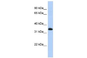 WB Suggested Anti-ZNF511 Antibody Titration:  0.