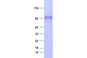 Western Blotting (WB) image for EPH Receptor A5 (EPHA5) protein (DYKDDDDK Tag) (ABIN2720240)