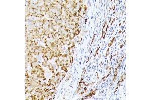 Immunohistochemistry of paraffin-embedded rat ovary using BMPR1B Rabbit pAb (ABIN3022719, ABIN3022720, ABIN3022721, ABIN1512645 and ABIN6219169) at dilution of 1:350 (40x lens). (BMPR1B antibody  (AA 1-126))