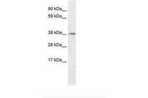 Image no. 2 for anti-Proteasome (Prosome, Macropain) 26S Subunit, Non-ATPase, 11 (PSMD11) (AA 276-325) antibody (ABIN202488)