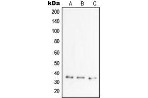 Western blot analysis of TSG6 expression in MCF7 (A), HCT15 (B), HeLa (C) whole cell lysates. (TNFAIP6 antibody  (Center))