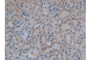 DAB staining on IHC-P; Samples: Rat Kidney Tissue (VPREB1 antibody  (AA 43-128))