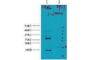 Western Blotting (WB) image for anti-Carbonic Anhydrase IX (CA9) antibody (ABIN3181146) (CA9 antibody)
