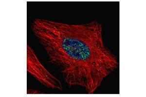 ICC/IF Image Confocal immunofluorescence analysis (Olympus FV10i) of paraformaldehyde-fixed HeLa, using WTAP, antibody (Green) at 1:500 dilution. (WTAP antibody  (Center))