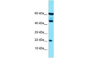 Host: Rabbit Target Name: PLA2G12B Sample Type: HT1080 Whole Cell lysates Antibody Dilution: 1. (PLA2G12B antibody  (N-Term))