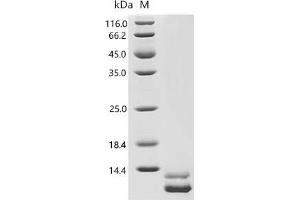 Chemokine (C-X-C Motif) Ligand 1 (Melanoma Growth Stimulating Activity, Alpha) (CXCL1) (AA 35-107), (full length) protein (His tag)