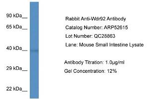 Western Blotting (WB) image for anti-WD Repeat Domain 92 (WDR92) (Middle Region) antibody (ABIN2785012) (WDR92 antibody  (Middle Region))