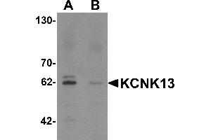 Western blot analysis of KCNK13 in rat brain tissue lysate with KCNK13 antibody at 0. (KCNK13 antibody  (Middle Region))