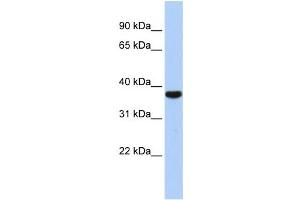 Western Blotting (WB) image for anti-Exosome Component 2 (EXOSC2) antibody (ABIN2458529) (EXOSC2 antibody)