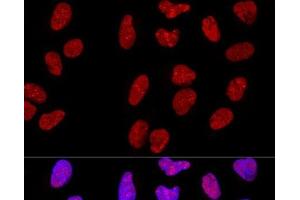 Confocal immunofluorescence analysis of U-2 OS cells using METTL3 Polyclonal Antibody at dilution of 1:200. (METTL3 antibody)