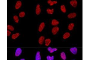 Confocal immunofluorescence analysis of U-2 OS cells using METTL3 Polyclonal Antibody at dilution of 1:200. (METTL3 antibody)