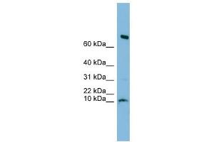 C1orf122 antibody used at 1 ug/ml to detect target protein. (C1orf122 antibody  (N-Term))