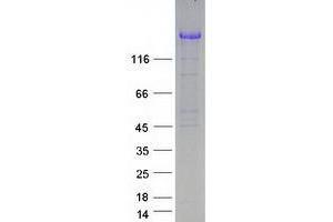 Western Blotting (WB) image for Ubiquitin-Conjugating Enzyme E2O (UBE2O) protein (Myc-DYKDDDDK Tag) (ABIN2734861)