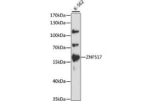 Western blot analysis of extracts of K-562 cells, using ZNF517 antibody (ABIN7271495) at 1:1000 dilution. (ZNF517 antibody  (AA 70-180))