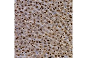 Immunohistochemistry of paraffin-embedded rat lung using AHR Rabbit pAb (ABIN3015499, ABIN3015500, ABIN5663909 and ABIN6218543) at dilution of 1:100 (40x lens). (Aryl Hydrocarbon Receptor antibody  (AA 619-848))