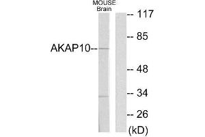Western Blotting (WB) image for anti-A Kinase (PRKA) Anchor Protein 10 (AKAP10) (N-Term) antibody (ABIN1848976) (AKAP10 antibody  (N-Term))