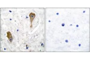 Immunohistochemistry analysis of paraffin-embedded human brain tissue, using GAD1 Antibody. (GAD antibody  (AA 471-520))