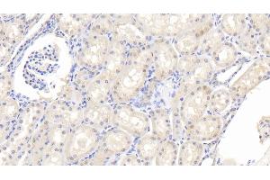 Detection of IL1RA in Bovine Kidney Tissue using Polyclonal Antibody to Interleukin 1 Receptor Antagonist (IL1RA) (IL1RN antibody  (AA 24-174))
