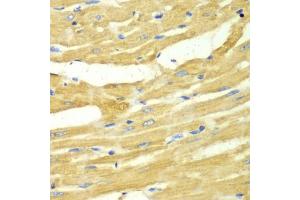 Immunohistochemistry of paraffin-embedded rat heart using OGT antibody (ABIN4904611) at dilution of 1:100 (40x lens).