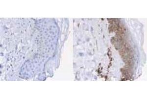 Immunohistochemistry of Rabbit anti-Beta-2-Microglobulin Antibody. (beta-2 Microglobulin antibody)