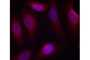 Immunofluorescence staining of methanol-fixed Hela cells using SEK1/MKK4(Phospho-Ser80) Antibody. (MAP2K4 antibody  (pSer80))