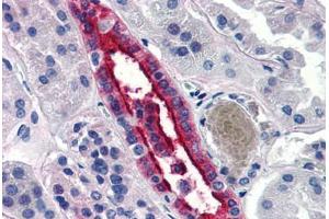 Human Kidney (formalin-fixed, paraffin-embedded) stained with AQP2 antibody ABIN290706 at 20 ug/ml followed by biotinylated goat anti-rabbit IgG secondary antibody ABIN481713, alkaline phosphatase-streptavidin and chromogen. (AQP2 antibody  (N-Term))