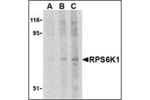 Western blot analysis of RPS6K1 in Jurkat cell lysate with this product at (A) 2. (RPS6KA1 antibody  (C-Term))