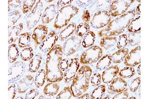 Formalin-fixed, paraffin-embedded human Renal Cell Carcinoma stained with Laminin Rat Monoclonal Antibody (A5). (Laminin gamma 1 antibody)