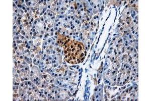 Immunohistochemical staining of paraffin-embedded Kidney tissue using anti-PSMC3mouse monoclonal antibody. (PSMC3 antibody)