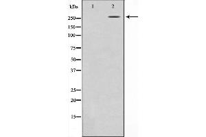 Western blot analysis on HeLa cell lysate using CBP Antibody. (CBP antibody  (C-Term))