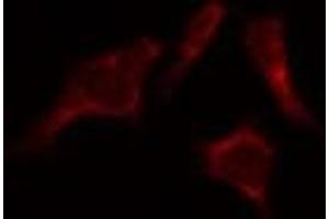 ABIN6274096 staining HepG2 by IF/ICC. (EPH Receptor B6 antibody  (Internal Region))