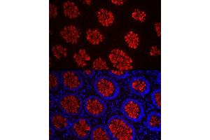 Immunofluorescence analysis of human colon carcinoma cells using MUC2 Rabbit pAb (ABIN7268690) at dilution of 1:50 (40x lens).