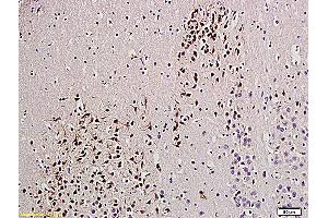 Formalin-fixed and paraffin embedded rat brain labeled with Anti-UCHL1/PGP9. (UCHL1 antibody  (AA 35-140))