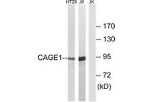 Western blot analysis of extracts from HT-29/Jurkat cells, using CAGE1 Antibody.