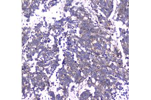 IHC analysis of RAB27A using anti-RAB27A antibody . (RAB27A antibody  (AA 98-216))