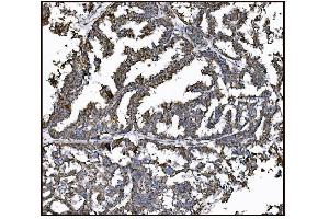 IHC analysis of FABP-1/GOT2 using anti-FABP-1/GOT2 antibody (ABIN7601426). (GOT2 antibody  (AA 35-430))