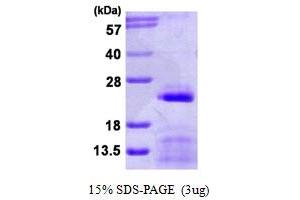 SNRPC Protein (AA 1-159) (His tag)
