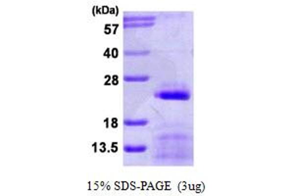SNRPC Protein (AA 1-159) (His tag)