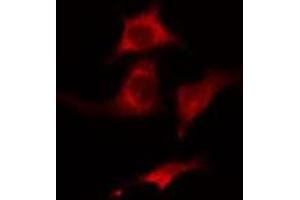 ABIN6275440 staining HuvEc cells by IF/ICC. (Radixin antibody  (Internal Region))