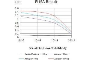 Black line: Control Antigen (100 ng),Purple line: Antigen (10 ng), Blue line: Antigen (50 ng), Red line:Antigen (100 ng) (CD5 antibody  (AA 403-495))