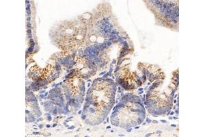 Immunohistochemistry analysis of paraffin-embedded mouse duodenum using,Arg2 (ABIN7073115) at dilution of 1: 600 (ARG2 antibody)