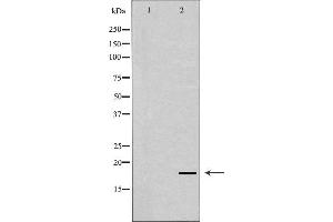 Western blot analysis of Hela whole cell lysates, using SKP1 Antibody. (SKP1 antibody  (Internal Region))