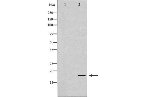 SKP1 antibody  (Internal Region)