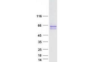 Validation with Western Blot