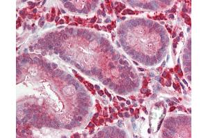 Human Small Intestine: Formalin-Fixed, Paraffin-Embedded (FFPE) (BCL3 antibody  (AA 2-13))