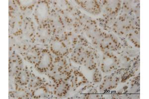 Immunoperoxidase of monoclonal antibody to PPP3CA on formalin-fixed paraffin-embedded human stomach. (PPP3CA antibody  (AA 1-84))