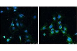Immunofluorescence analysis of LC3B Antibody  in Rat brain before (left) and after (right) treatment with rapamycin (100 nm for 4 hr). (LC3B antibody  (N-Term))