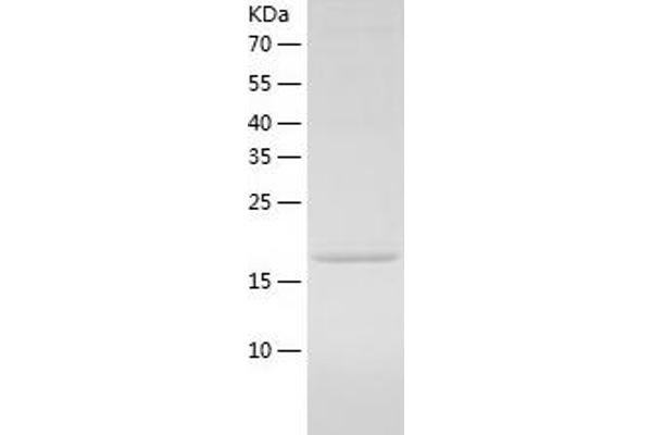 PROX1 Protein (AA 547-737) (His tag)
