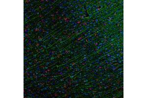 Image no. 3 for anti-Chemokine (C-C Motif) Ligand 5 (CCL5) antibody (ABIN465753) (CCL5 antibody)